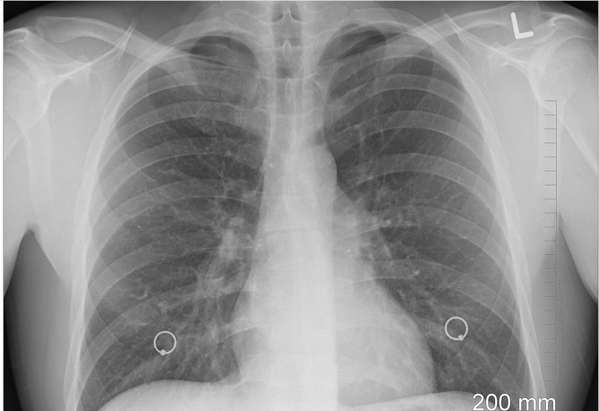 human ribs